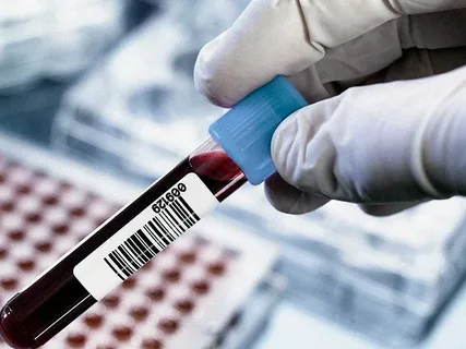 تصویر 4 از کیت تشخیص خون مخفی در مدفوع با کیفیت ساخت بالا